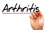 arthritis spelled 242956141